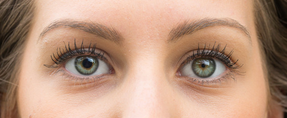 What is Anisocoria?