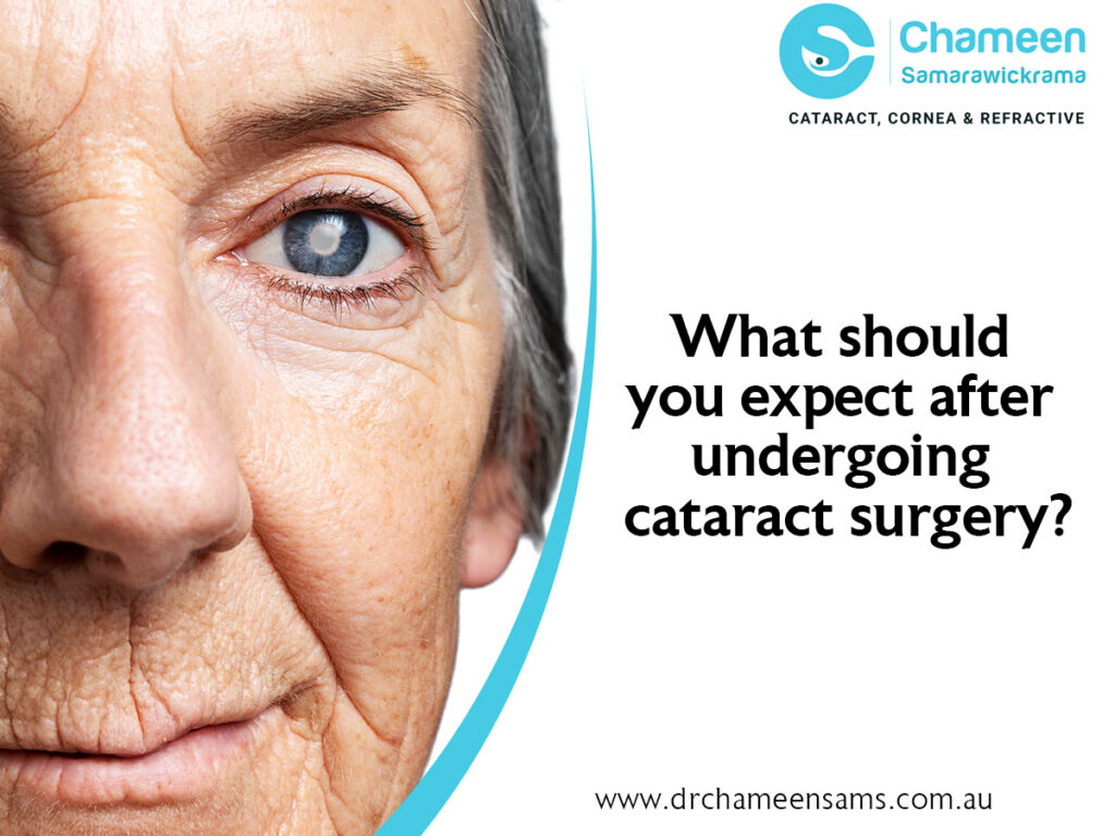 Expectation after undergoing cataract surgery?