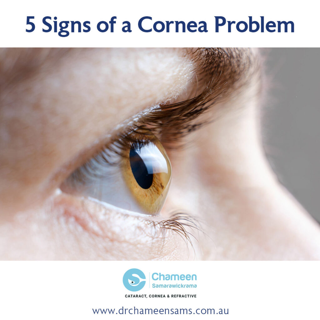 Signs of a Cornea Problem