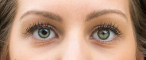 What is Anisocoria?