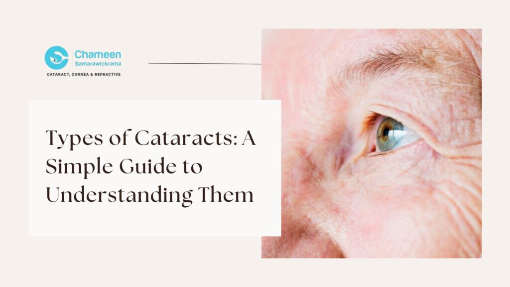 Types of Cataracts