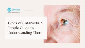 Types of Cataracts